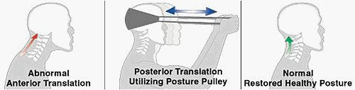 Posture Pulley Neck Exerciser